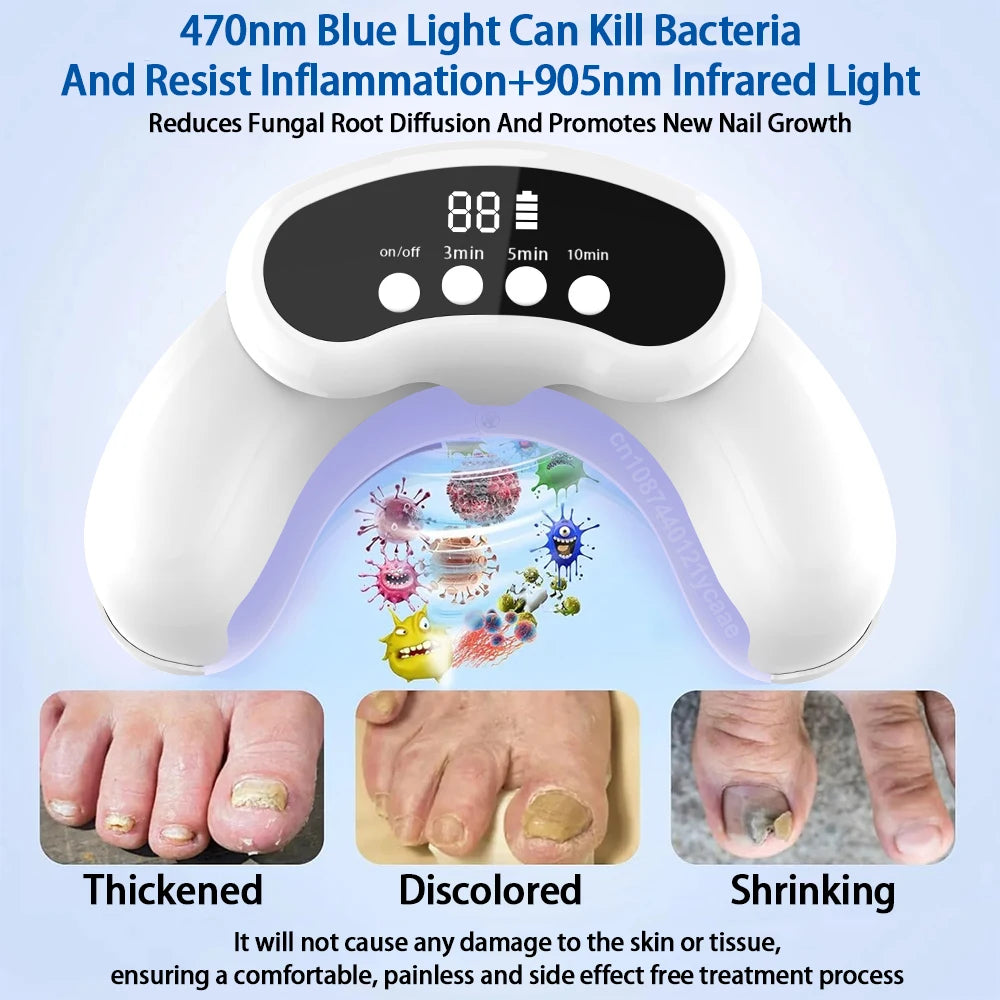 Nail Fungus Cleaning Laser Device For Multiple Toenail Repair