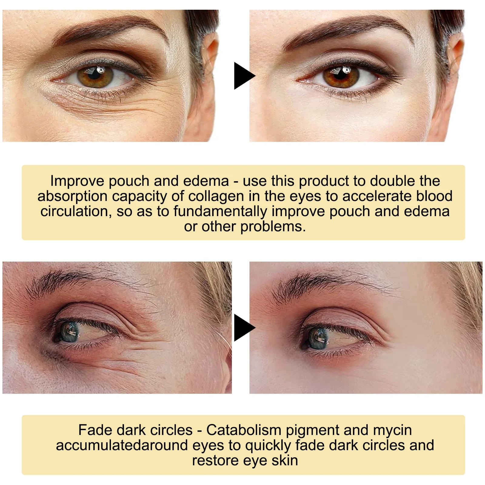 24K Gold Eye Mask Removal Eyes Bags Anti Dark Circles